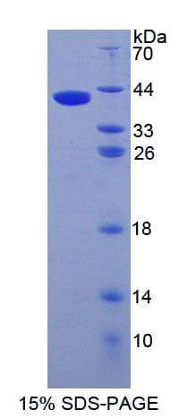 Human AMIGO Protein (Recombinant His-T7)
