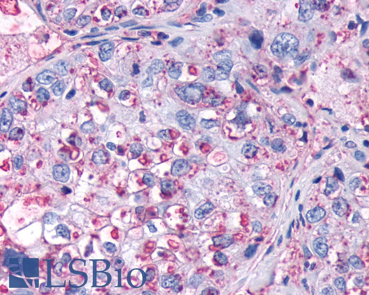 IHC-plus™ FZD4 / Frizzled 4 Antibody (N-Terminus)