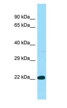Polyclonal Rabbit anti-Human BLOC1S3 Antibody (aa48-97, WB)