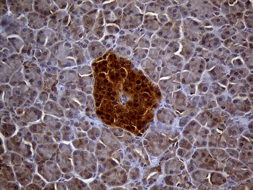 TRXR1 / TXNRD1 Antibody (clone OTI7B2, Carrier-free)