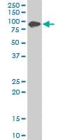 IHC-plus™ Zyxin Antibody (clone 2D1)