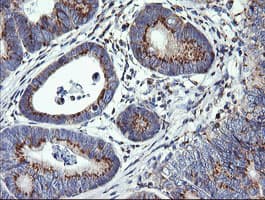VTI1A Antibody (clone OTI1F4)