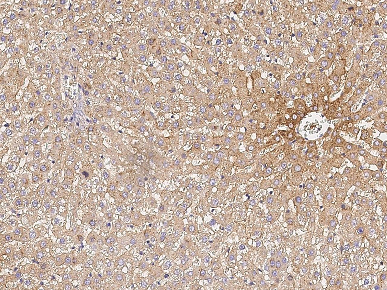 TF / Transferrin Antibody (clone 005, Preservative Free)