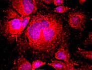 Polyclonal Rabbit anti-Mouse F8 / FVIII / Factor VIII Antibody (IHC, IF, WB)