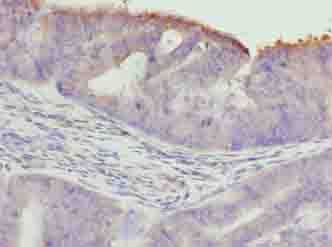 Polyclonal Rabbit anti-Human TTC30A Antibody (IHC, WB)