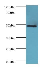 Polyclonal Rabbit anti-Human IFT57 / HIPPI Antibody (aa170-429, IHC, WB)