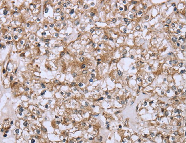 FCAR / CD89 Antibody