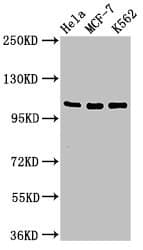 Polyclonal Rabbit anti-Human EVC / DWF-1 Antibody (IHC, WB)