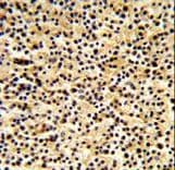 Polyclonal Rabbit anti-Human DTX1 / Deltex Antibody (aa382-410, IHC, WB)