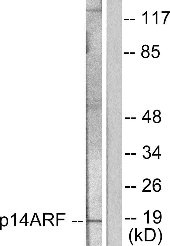 Polyclonal Rabbit anti-Human p14ARF / CDKN2A Antibody (IHC, IF, WB)