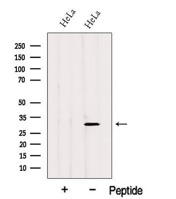 GSTO2 Antibody