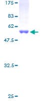 Human PSMB4 Protein (Recombinant GST)