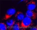 Polyclonal Rabbit anti-Human TRPM7 Antibody (4th Cytoplasmic Domain, IF, WB)