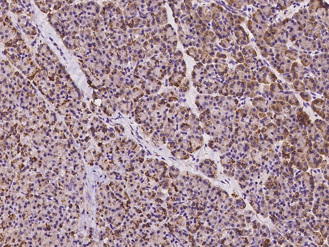 AGBL3 Antibody