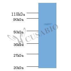 RECQ / DNA Helicase Antibody
