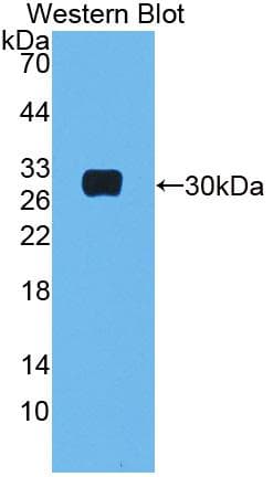 MBL2 / Mannose Binding Protein Antibody (aa19-244, Cy3)