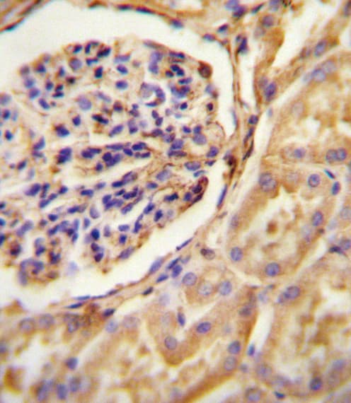 GNAT2 Antibody (aa140-169)