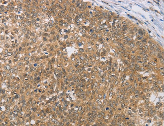 Polyclonal Rabbit anti-Human DIO1 / TXDI1 Antibody (IHC)
