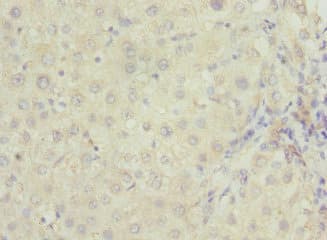 RAB23 Antibody
