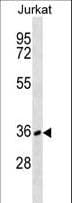 DNAM-1 / CD226 Antibody (aa307-335)