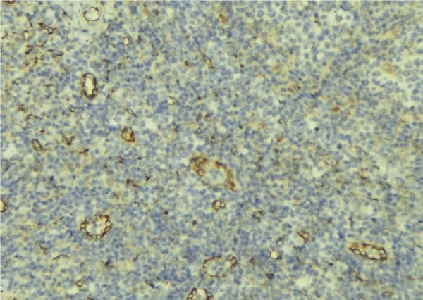 AOC3 / VAP-1 Antibody