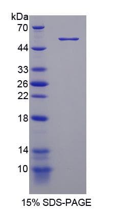 Human PDE4D Protein (Recombinant His-GST)