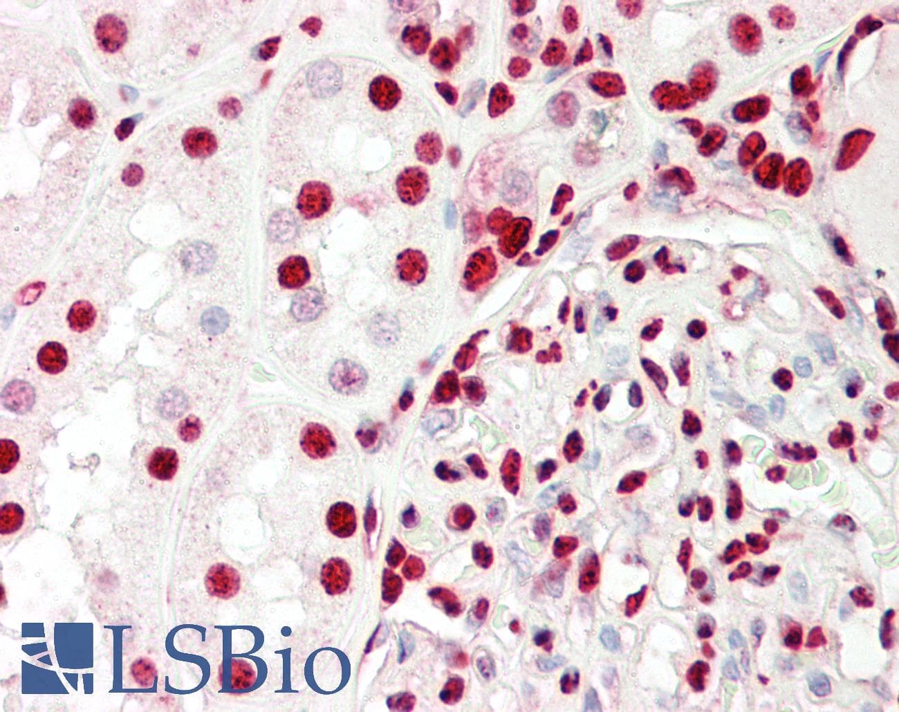 IHC-plus™ Polyclonal Rabbit anti-Human Ku70+Ku80 / XRCC6+XRCC5 Antibody (aa683-732, IHC, IF, WB)