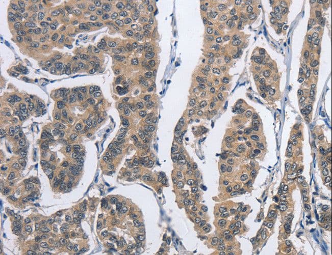 IHC-plus™ DSG2 / Desmoglein 2 Antibody