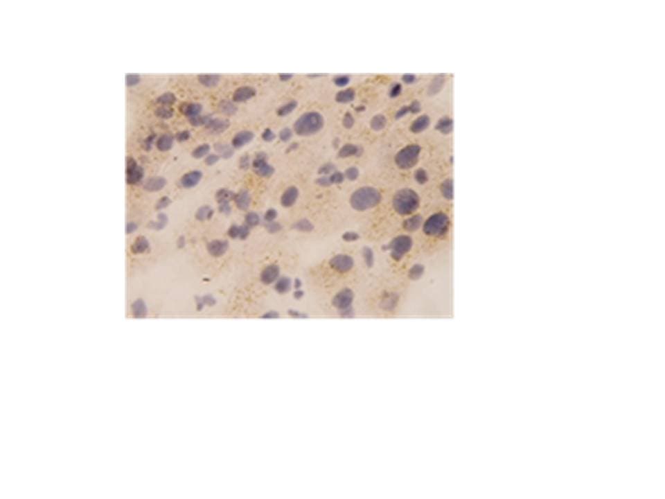 TNF Alpha Antibody