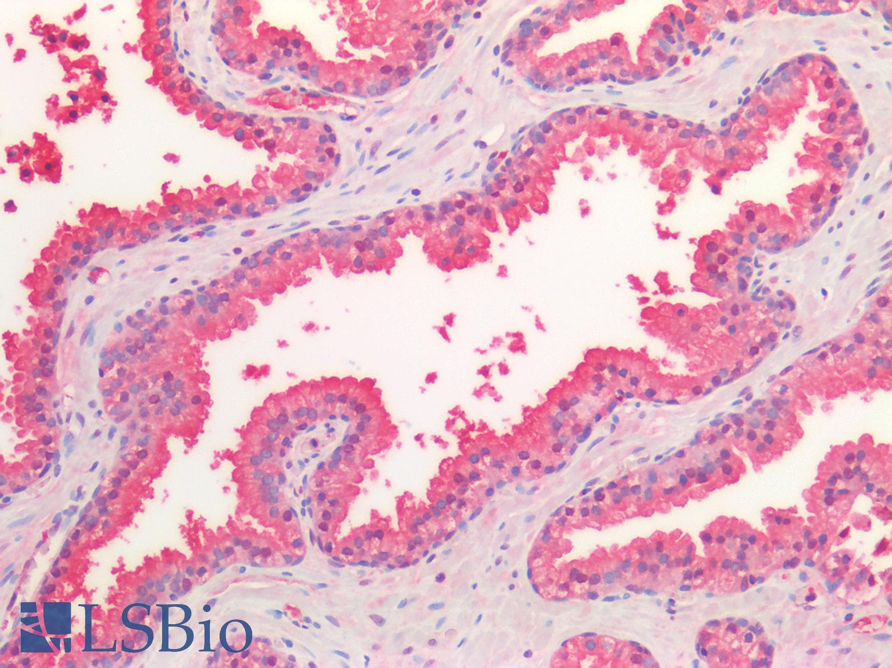 IHC-plus™ AZGP1 / ZAG Antibody (aa21-298, clone OTI10F2)