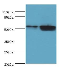 PathPlus™ KRT8 / CK8 / Cytokeratin 8 Antibody (aa2-483)