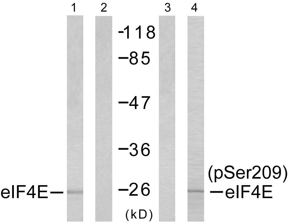 EIF4E Antibody (phospho-Ser209)