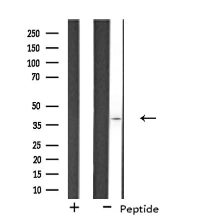 Polyclonal Rabbit anti-Human OSR2 Antibody (IF, WB)