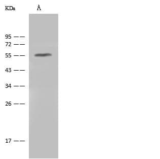 CD30 Antibody (Preservative Free)