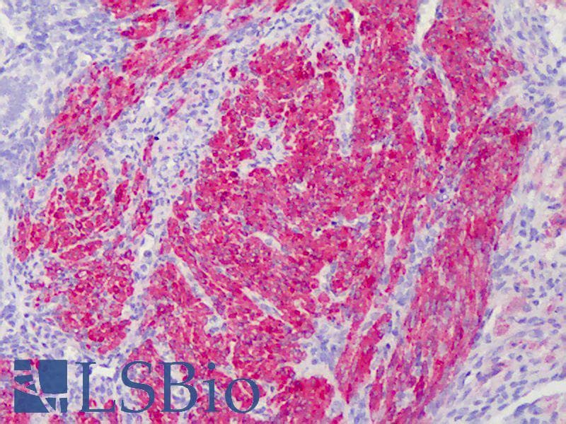 IHC-plus™ Monoclonal Mouse anti-Human CNN1 / Calponin Antibody (clone 2F5-1H4, IHC, WB)