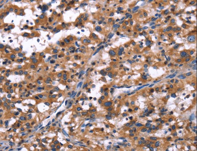 R3HCC1L / C10orf28 Antibody