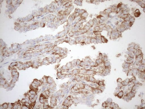KRT16 / CK16 / Cytokeratin 16 Antibody (clone OTI1G1, Carrier-free)