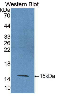 DPP4 / CD26 Antibody (aa638-767, Cy3)