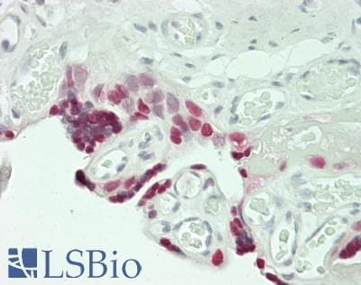 IHC-plus™ HMGB3 Antibody (aa125-175)
