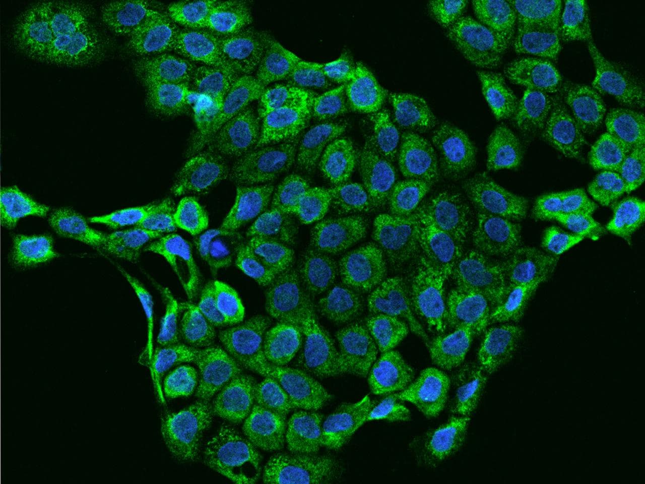 INHBB / Inhibin Beta B Antibody (Preservative Free)