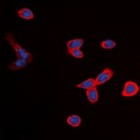 Polyclonal Rabbit anti-Human B1R / BDKRB1 Antibody (Internal, IF, WB)
