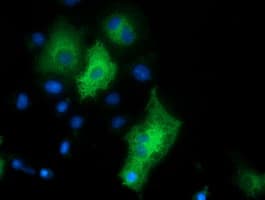 Monoclonal Mouse anti-Human HDAC6 Antibody (clone OTI5E6, IHC, IF, WB)