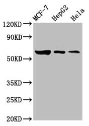 Polyclonal Rabbit anti-Human GBA / Glucosidase Beta Acid Antibody (IHC, WB)