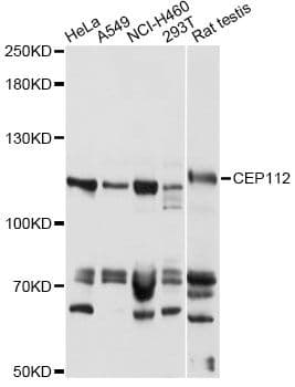 CCDC46 Antibody