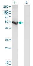 Monoclonal Mouse anti-Human CTSE / Cathepsin E Antibody (clone 2D5, WB)