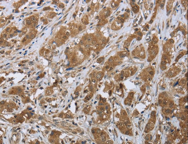 Polyclonal Rabbit anti-Human CLPS / Colipase Antibody (IHC)