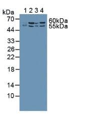 ME2 / Malate Dehydrogenase 2 Antibody (aa220-426, PE)