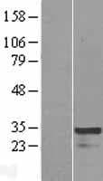 HOXC4 Protein (Over-Expression Lysate Myc-DDK (Flag))