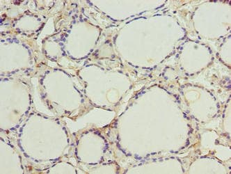 MTCP1NB Antibody