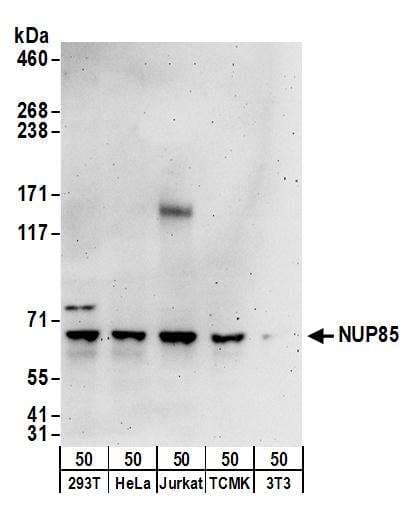 IHC-plus™ Polyclonal Rabbit anti-Human SNRPD3 Antibody (aa1-50, IHC, WB)